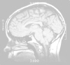 mri0006.jpg (24729 bytes)