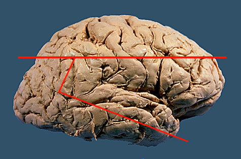 st1.jpg (52190 bytes)