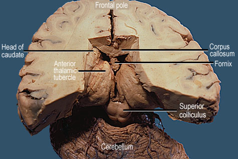 st5a.jpg (50623 bytes)