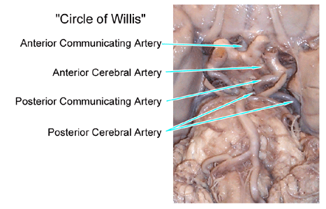 Circle of Willis