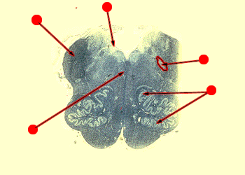 medial medulla