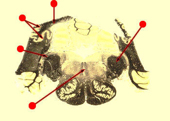 upper medulla