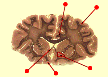 30q.gif (45987 bytes)
