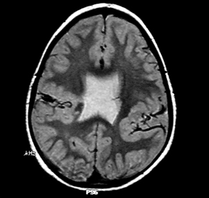 hol_ap.jpg (39047 bytes)